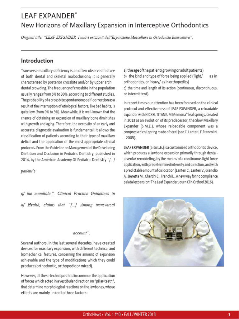 Leaf Expander New Horizonsof Maxillary Expansionin Interceptive ...