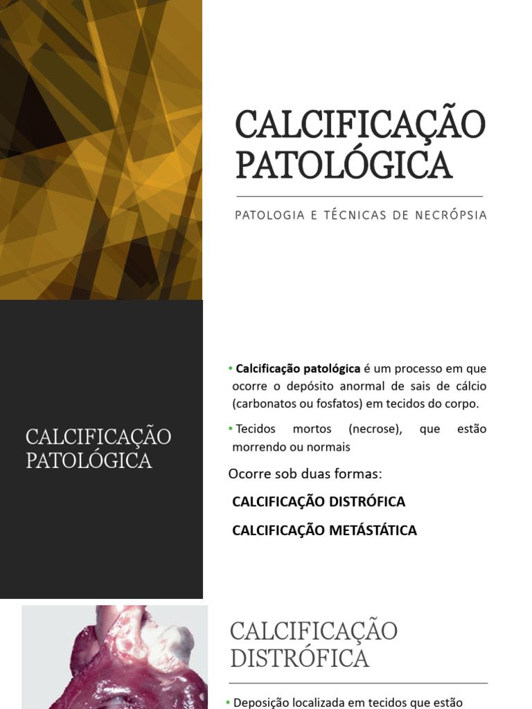 Calcificação Patológica: Tipos e Causas | PDF