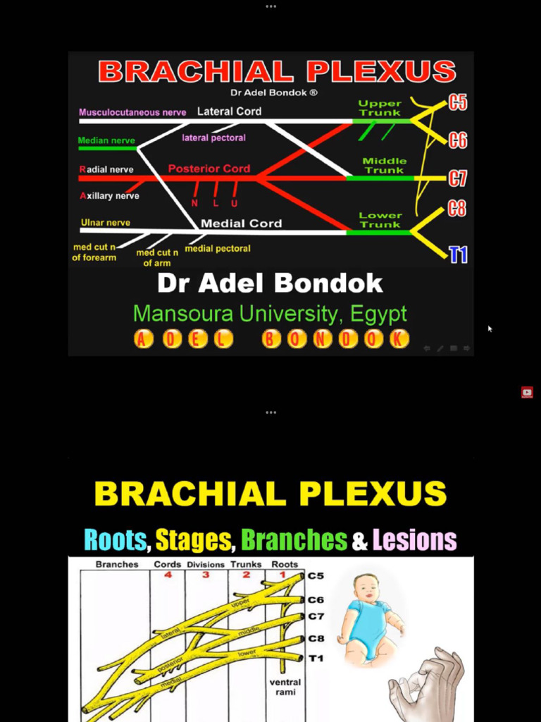 21- Brachial plexus | PDF