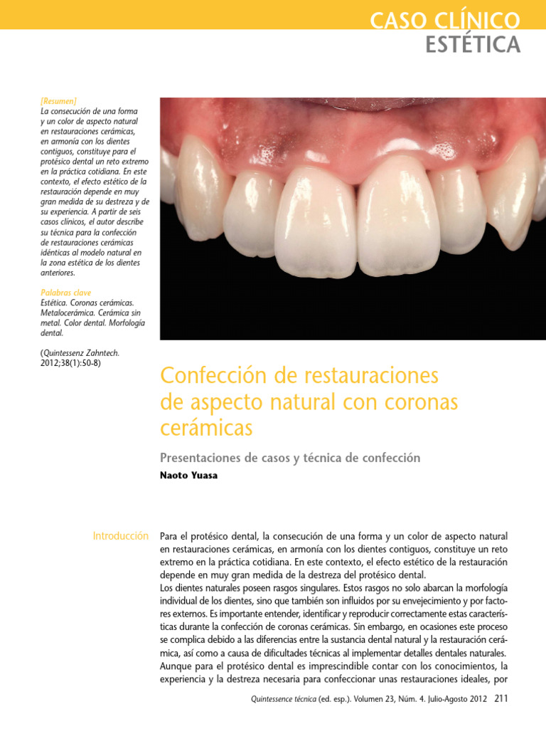 3 Confección de Restauraciones de Aspecto Natural Con Coronas Cerámicas ...
