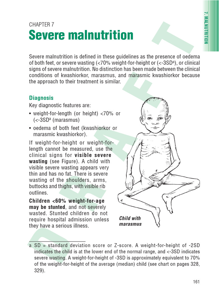 Severe Malnutrition Diagnosis and Treatment | PDF | Causes Of Death