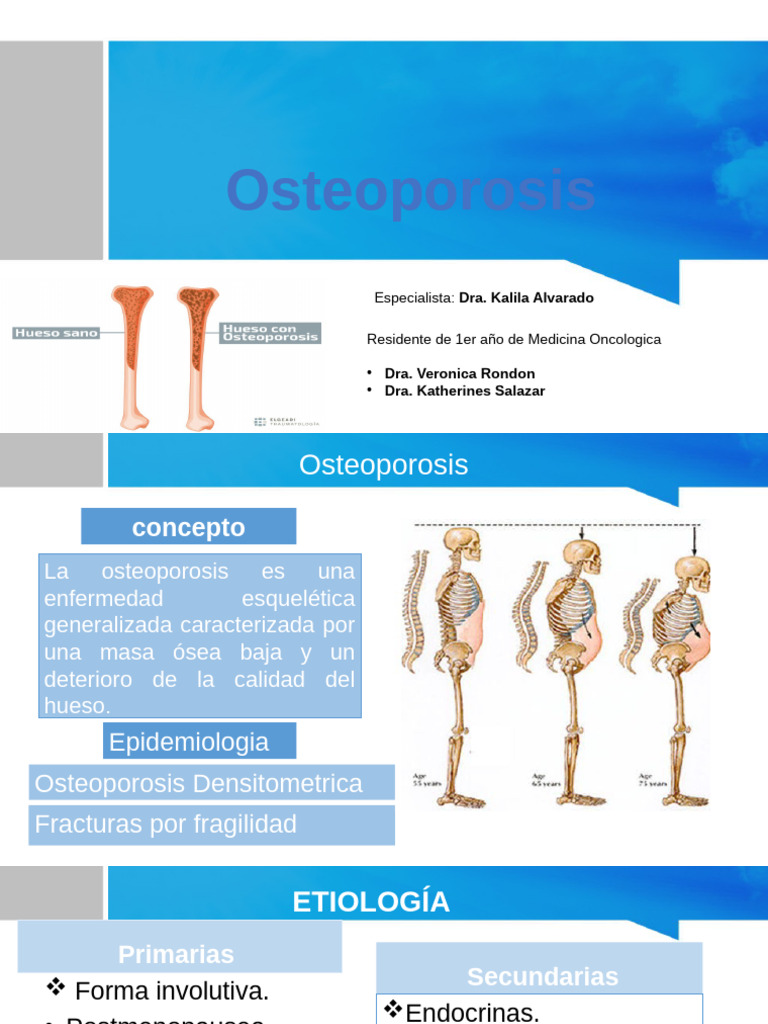 Guía Completa sobre Osteoporosis | PDF | Osteoporosis | Sistema esquelético