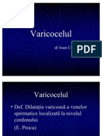 Varicocelul