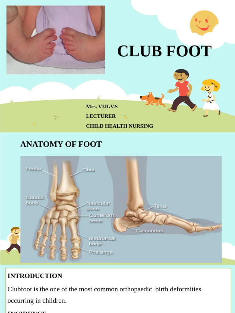 Understanding Clubfoot: Causes and Treatment | PDF | Foot ...