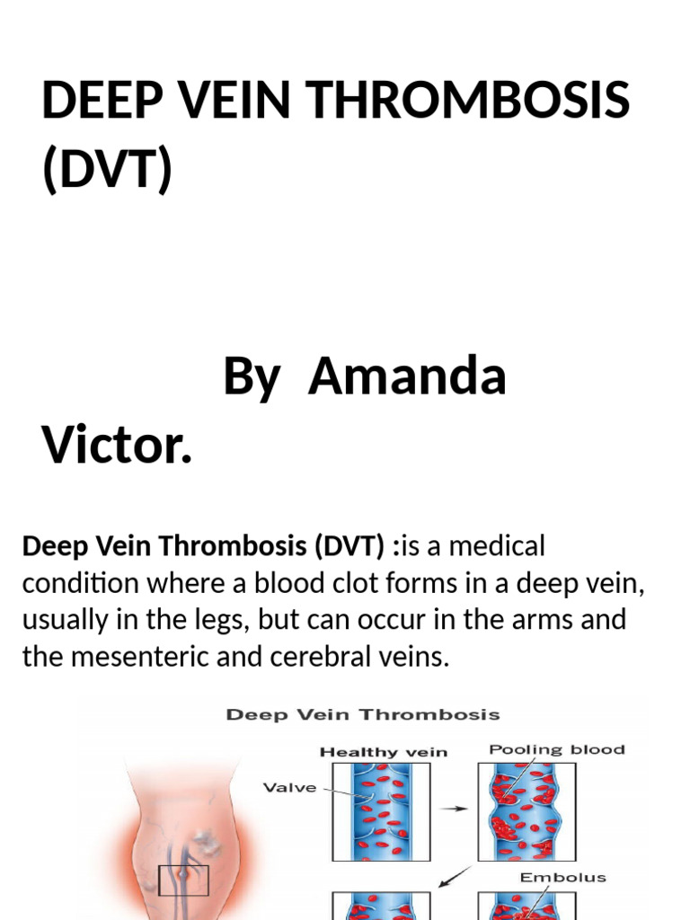 Deep Vein Thrombosis | PDF | Thrombosis | Vein