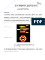 Invaginación intestinal en niños: desinvaginación neumática