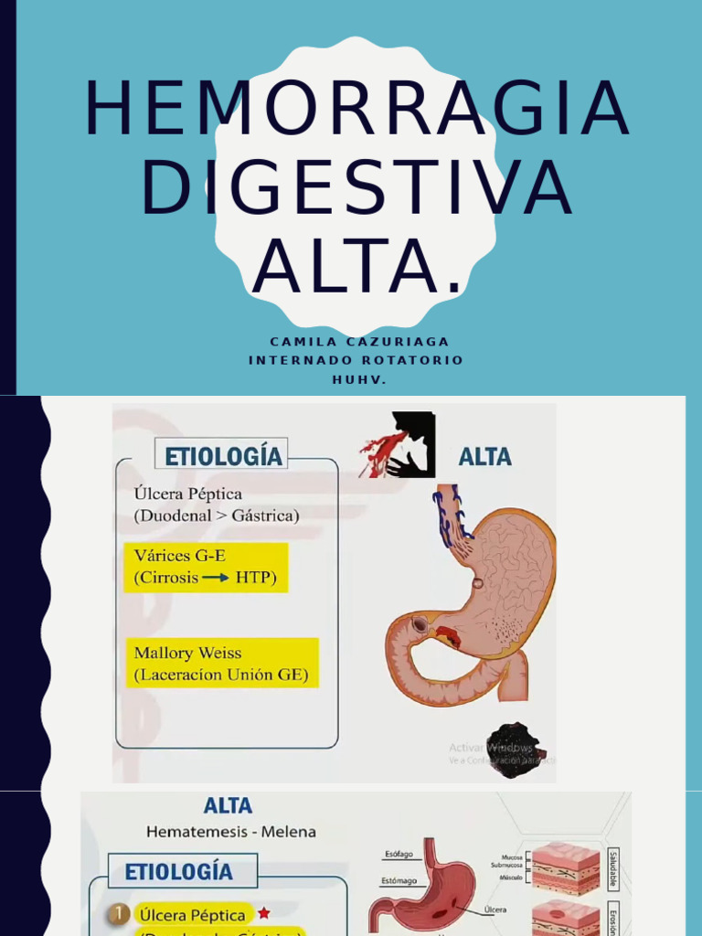 Hemorragia Digestiva Alta | PDF