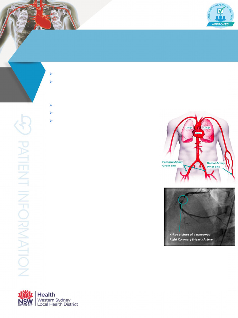 Coronary Angiogram Information Leaflet | PDF | Angiography | Internal ...