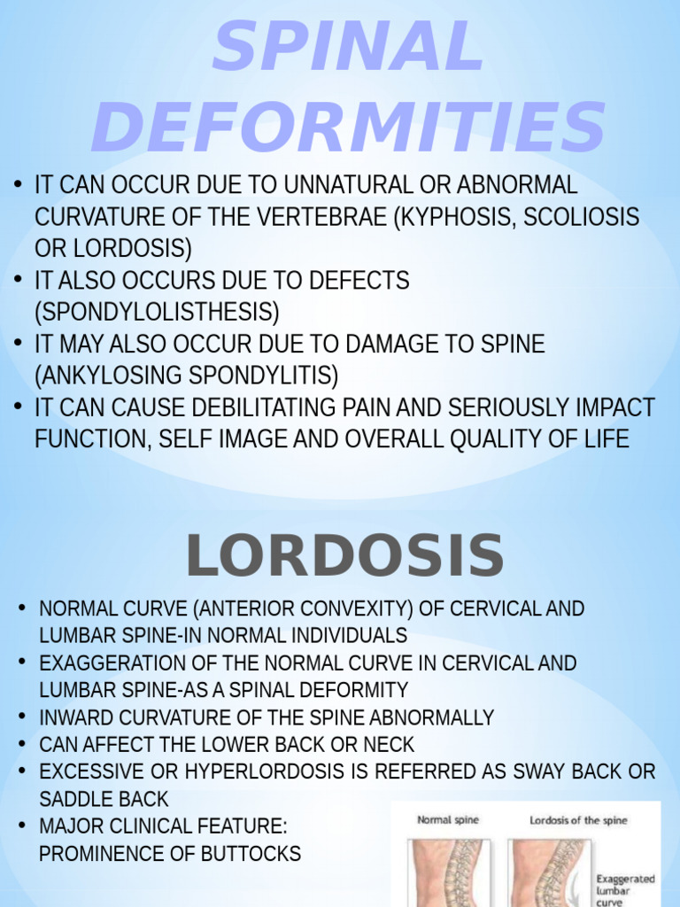 Understanding Spinal Deformities: Types & Causes | PDF | Vertebral ...