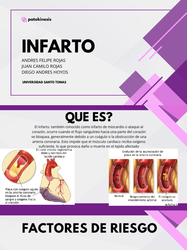 Causas y Tratamiento del Infarto | PDF | Aterosclerosis | Infarto de ...