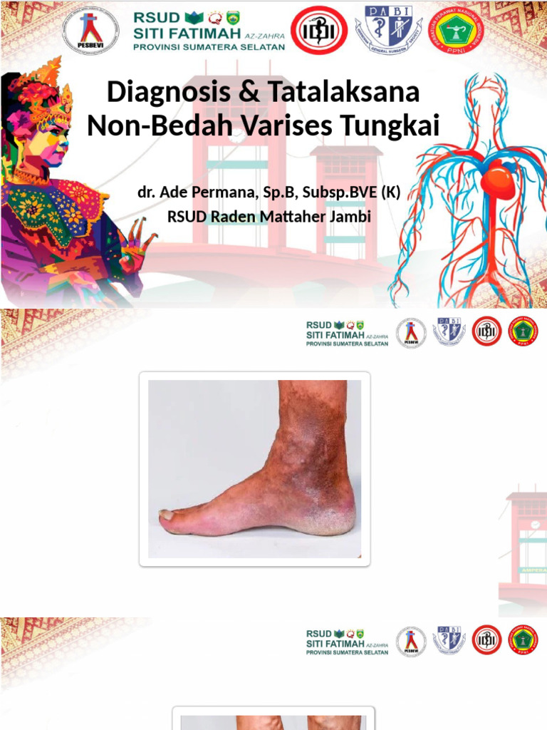 Diagnosis and Management of Varicose Veins | PDF | Vein | Angiology