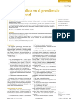 Carga Inmediata Dentadura Sobre Implantes