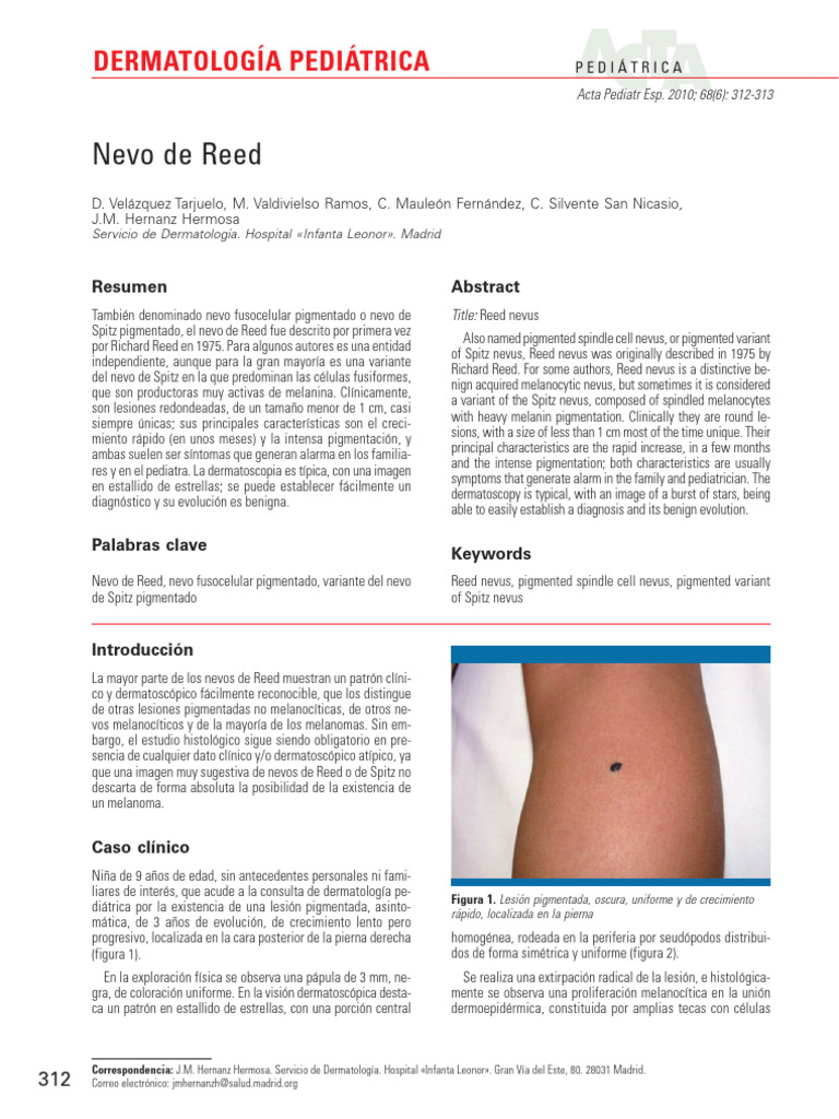 Nevo de Reed: Diagnóstico y Tratamiento | PDF | Epidermis | Melanoma
