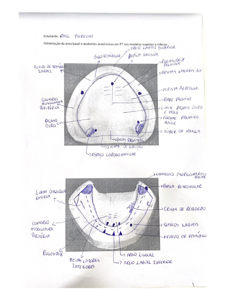 Delimitacao Da Area Basal e Acidentes Anatomicos em PT Nos Modelos ...