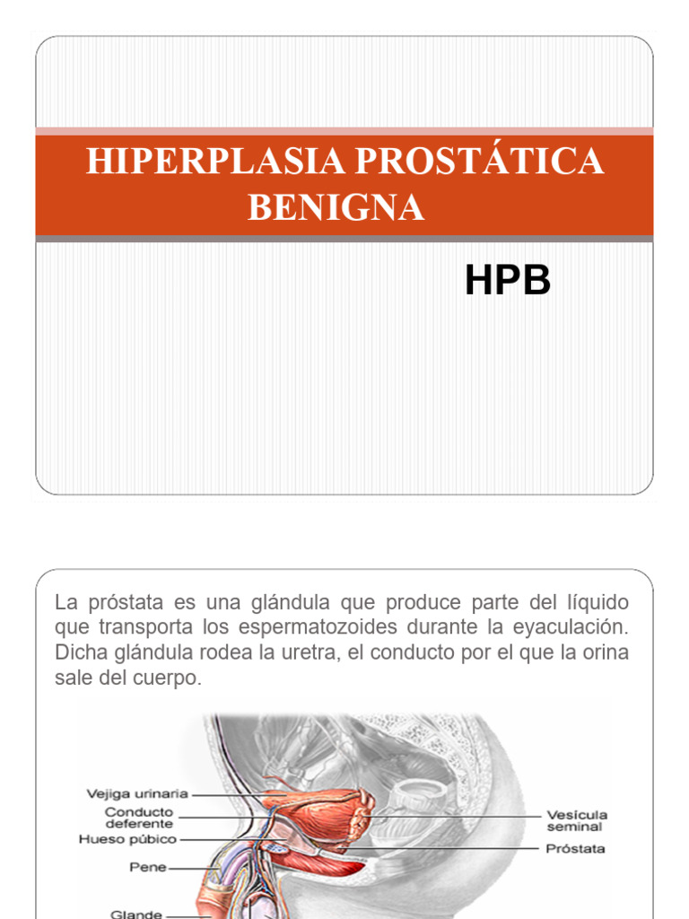 Hiperplasia Prostática: Síntomas y Tratamientos | PDF