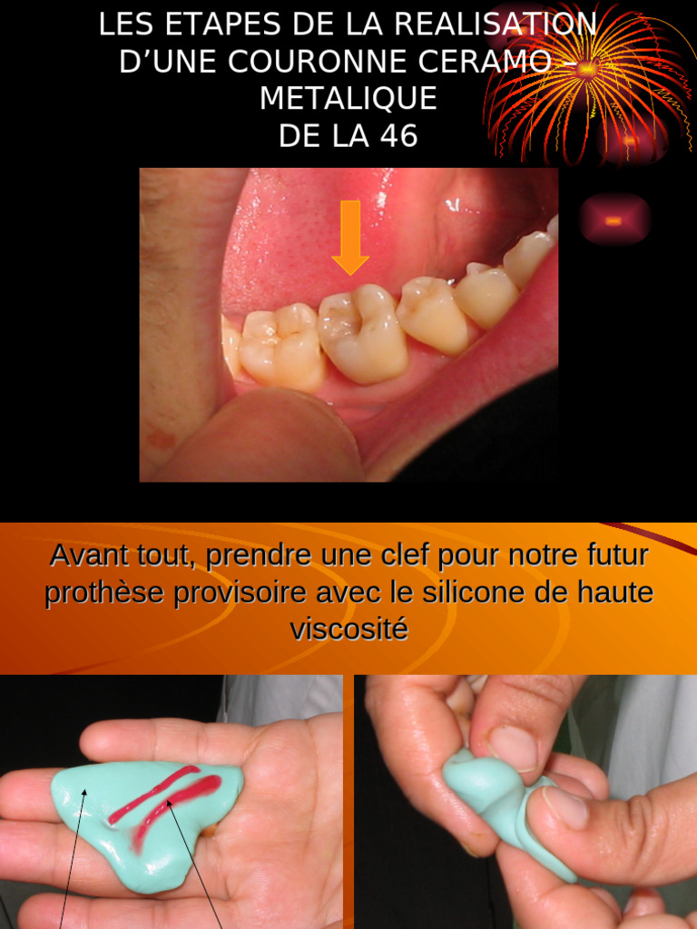 Gaine électrique ICTA Diamètre 40 mm Coupe au mètre