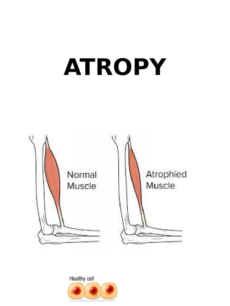 ATROPY | PDF