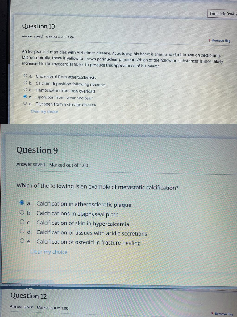 General Pathology Quiz Exam DDS-21 | PDF