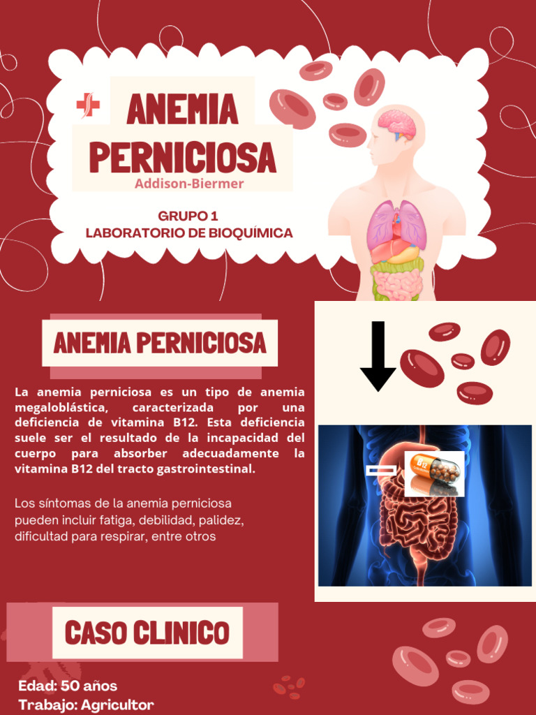 Anemia Perniciosa: Diagnóstico y Tratamiento | PDF | Anemia ...