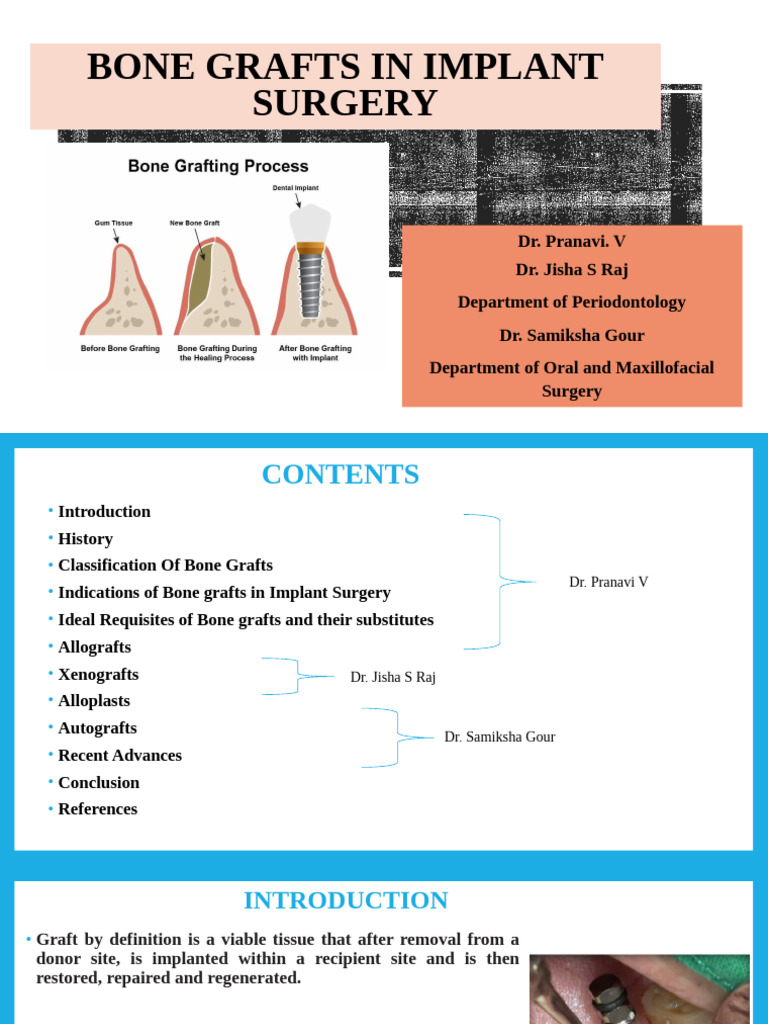 Bone Graft Combined Pdf Bone Osteoblast