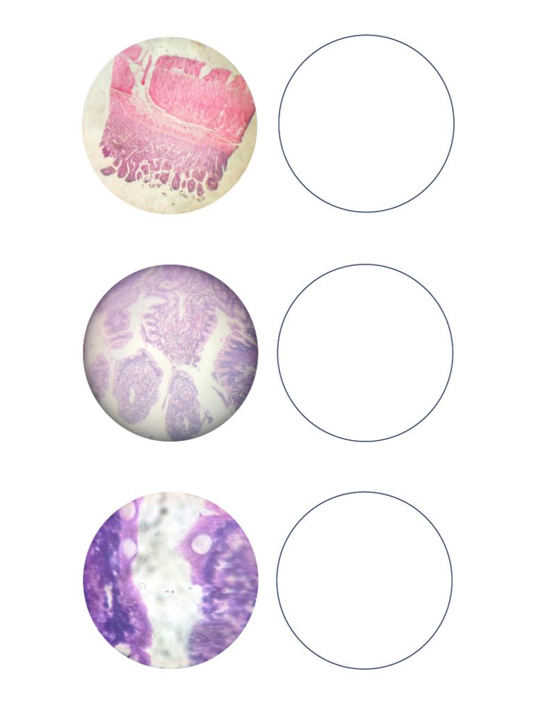 Final His To Colon | PDF