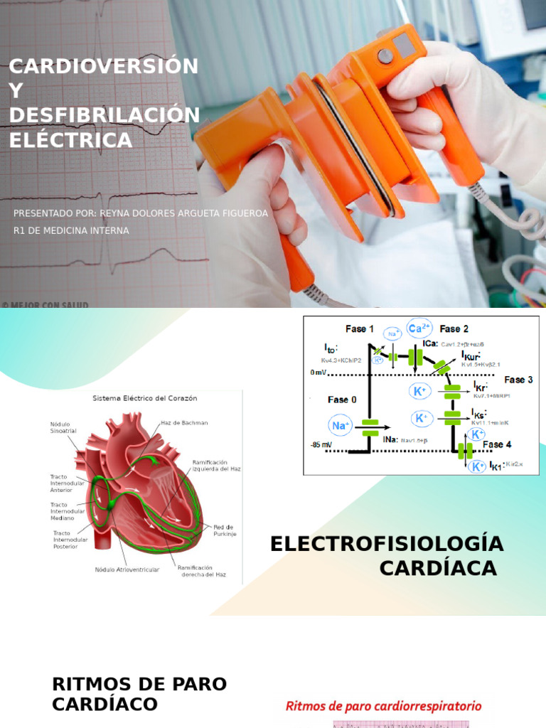 Cardioversión y Desfibrilación Eléctrica | PDF | Medicina CLINICA ...