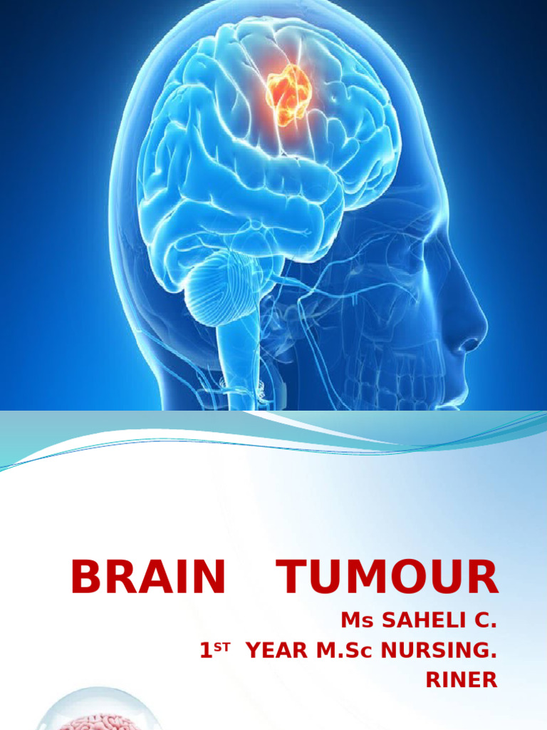 Braintumor 200509063728 | PDF | Brain Tumor | Radiation Therapy
