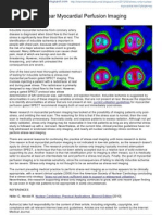 Stress-only Nuclear Myocardial Perfusion Imaging