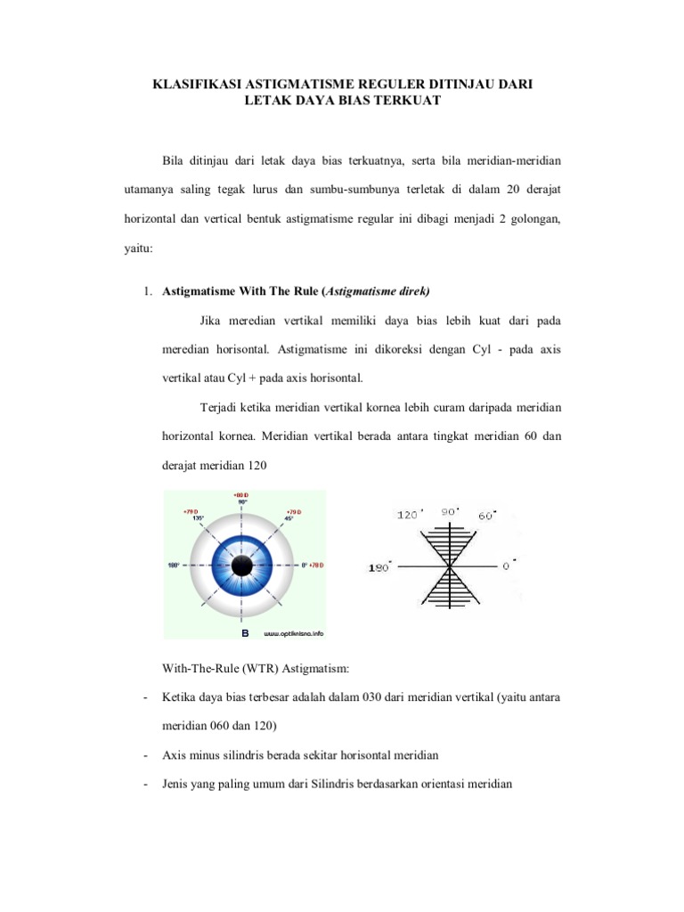 With The Rule Astigmatism | PDF