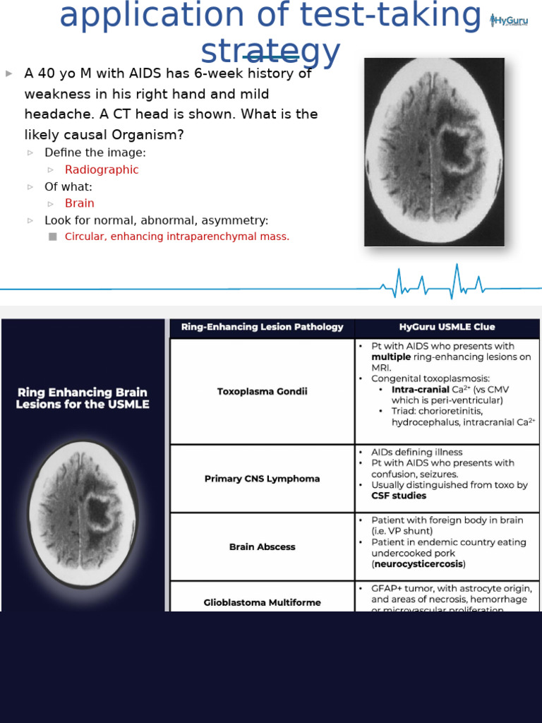 Top NBME Images PDF | PDF | Esophagus | Macrophage