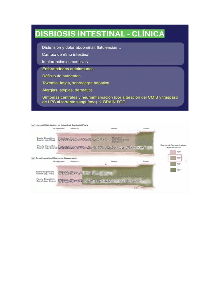 SIBO | PDF