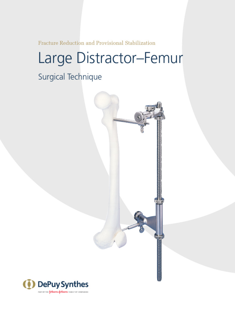 Large Femoral Distractor Surgical Guide | PDF | Skeletal System ...