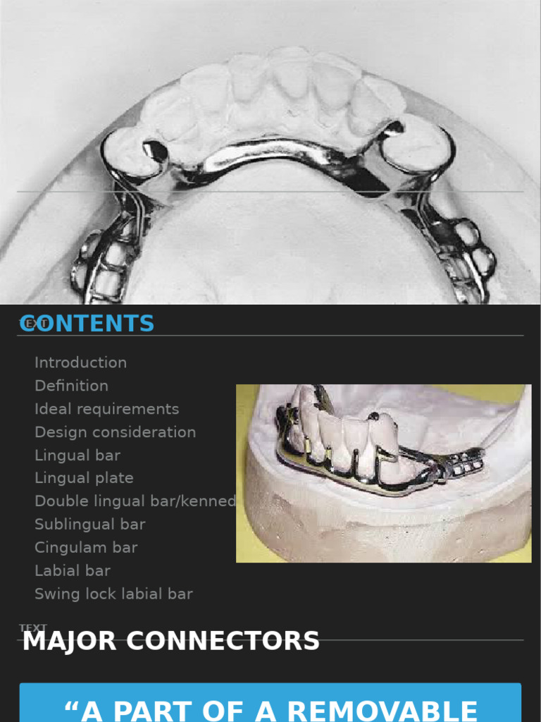Mandibular Major Connectors Overview | PDF | Dentistry Branches | Dentistry