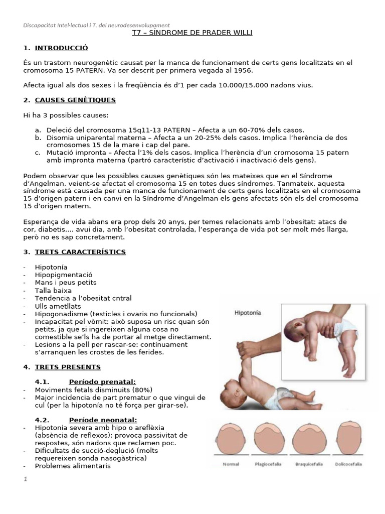 T7 - Síndrome de Prader Willi | PDF