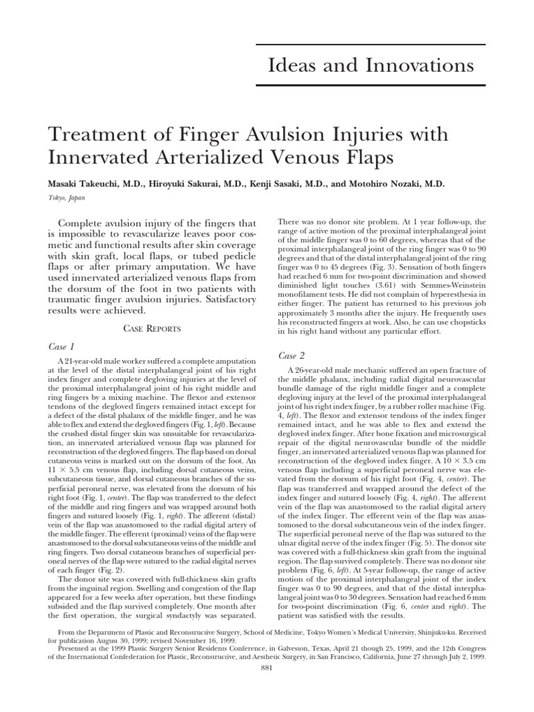 Finger Avulsion Injury Reconstruction Techniques | PDF | Finger | Vein