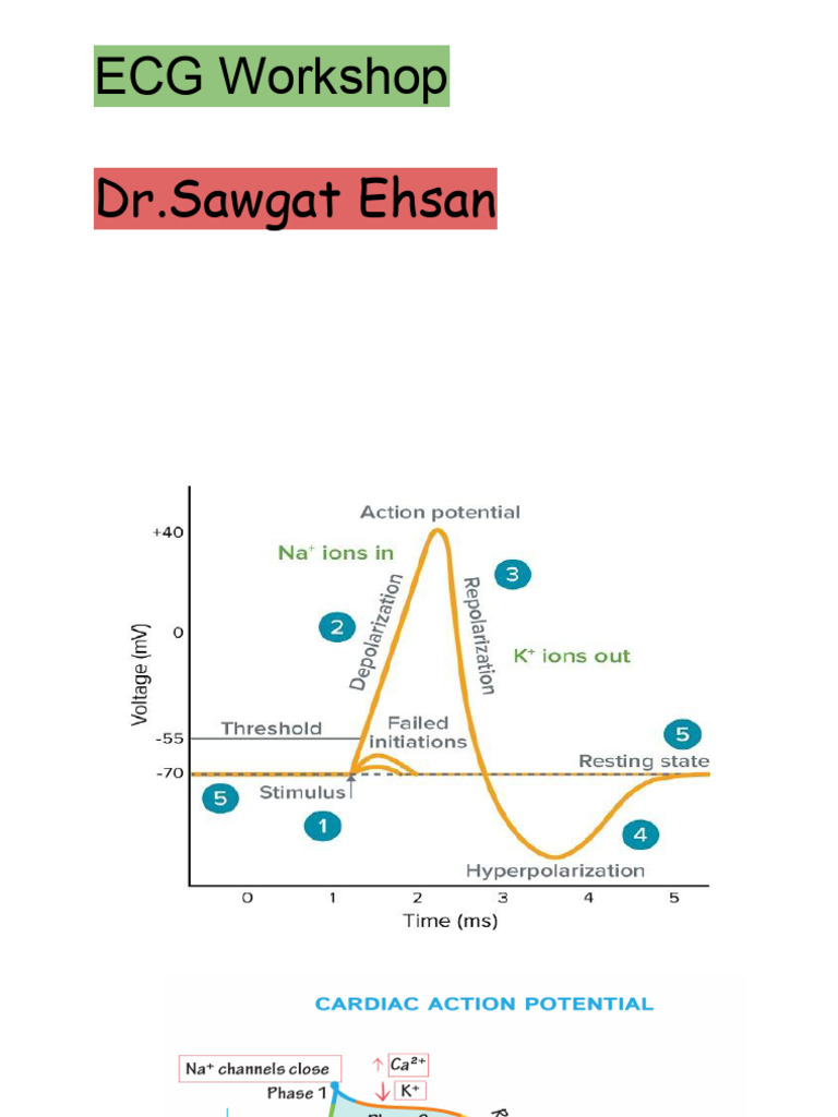 ECG Workshop by Dr. Sawgat Ehsan | PDF