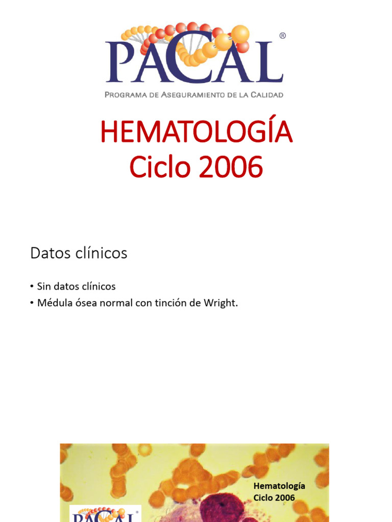 Caso hema 2006 pdf
