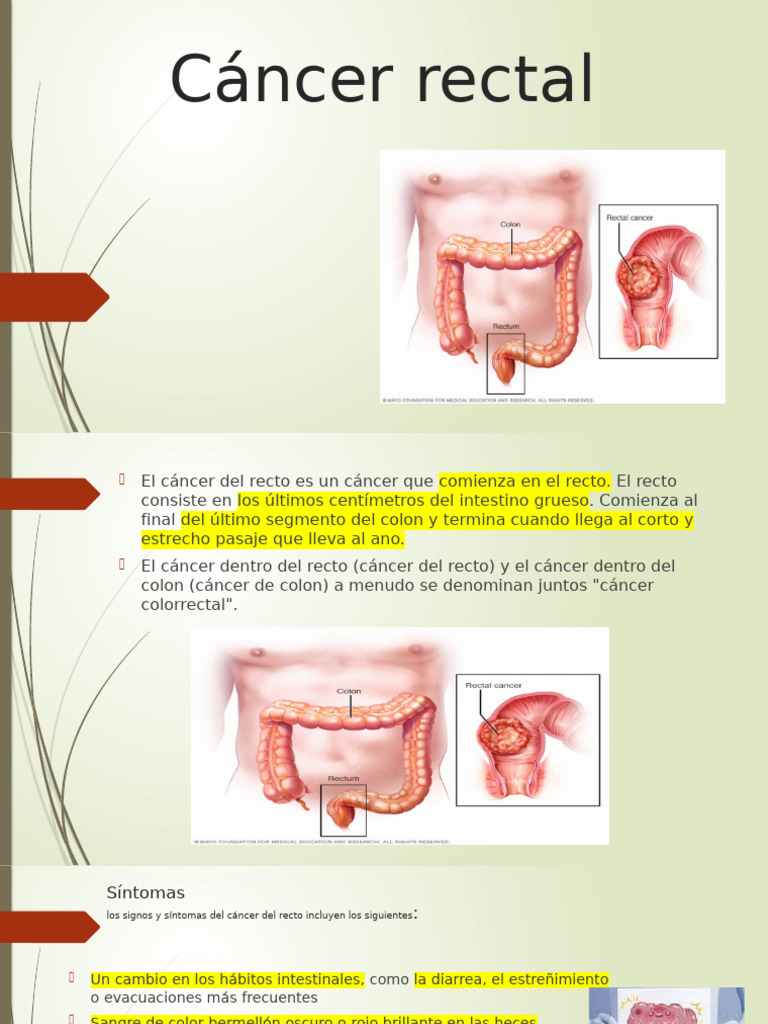 Cáncer Rectal | PDF | Cáncer colonrectal | Cáncer