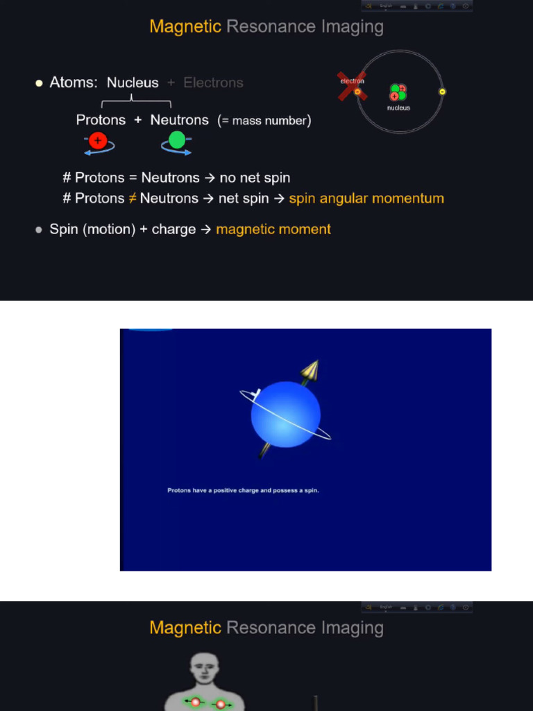Presentation1 MRI | PDF