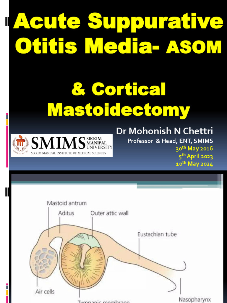 Acute Suppurative Otitis Media Guide | PDF | Human Head And Neck ...
