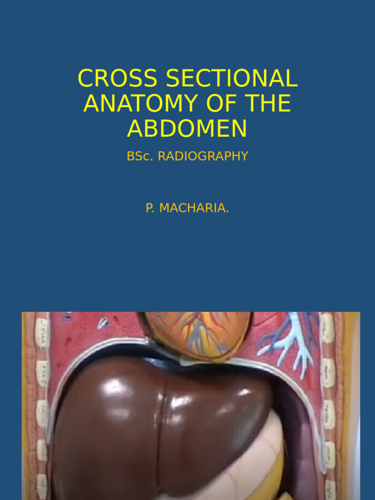Cross Sectional Anatomy of The Abdomen | PDF