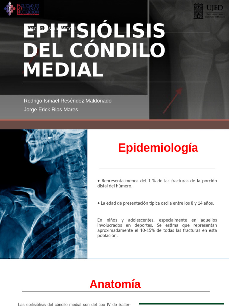 Epifisiólisis del Cóndilo Medial | PDF | Codo | Sistema musculoesquelético