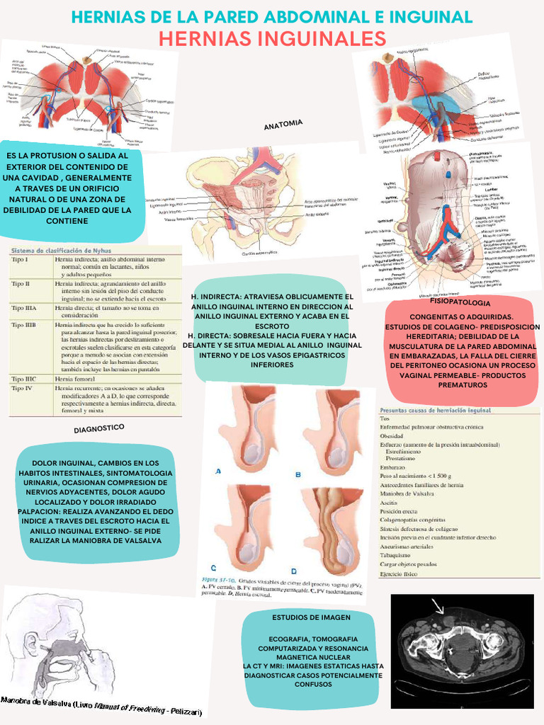Poster Hernias de La Pared Abdominal e Inguinales | PDF | Abdomen ...
