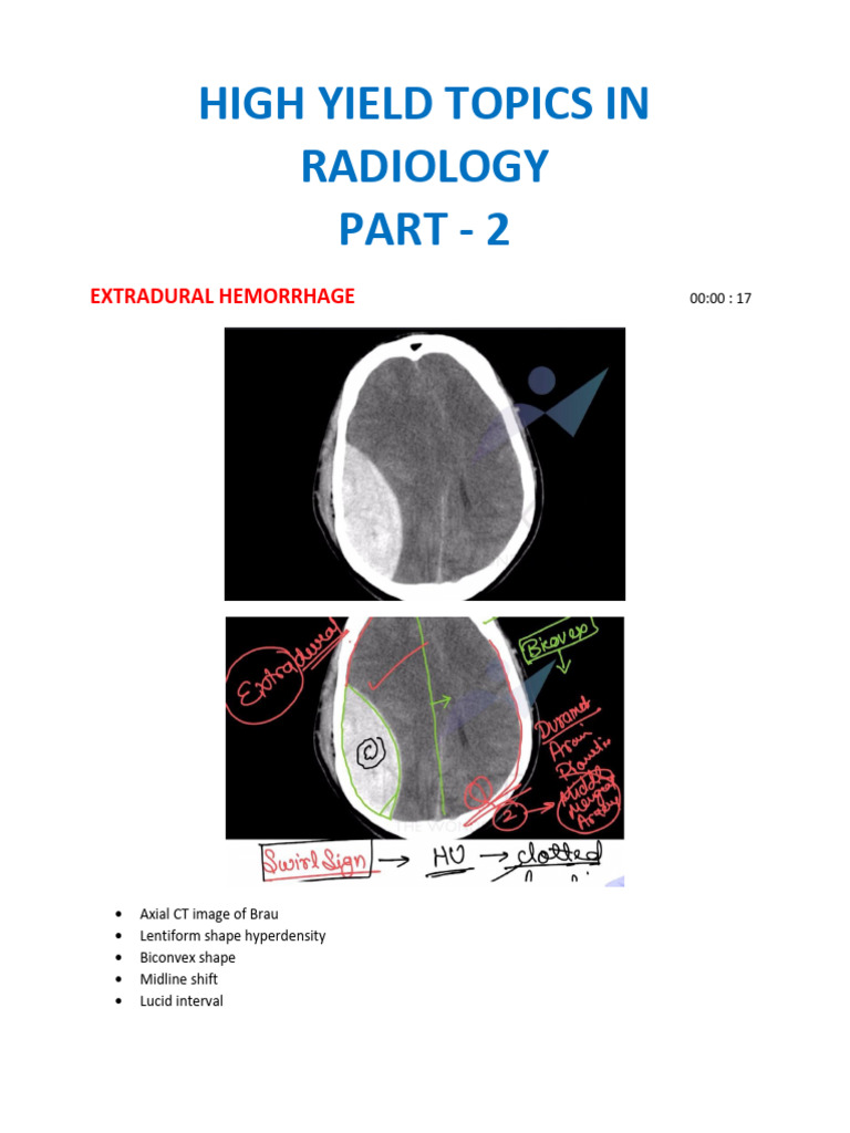 Radiology Hemorrhage Types Guide | PDF