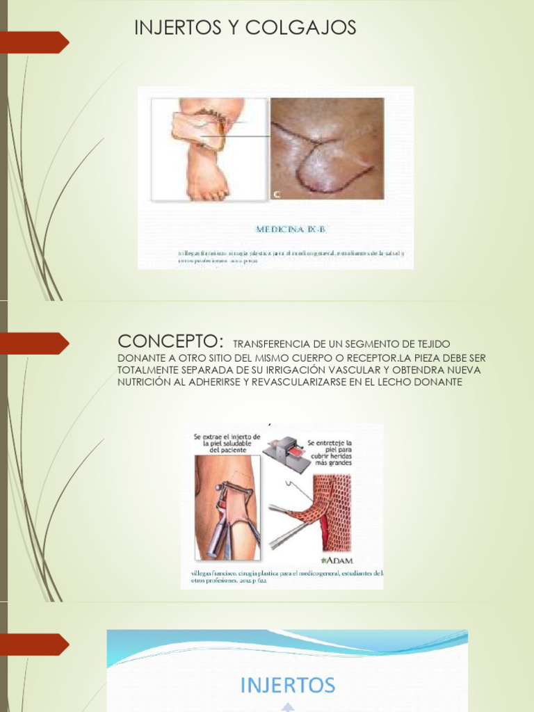 Injertos y Colgajos: Guía Completa | PDF