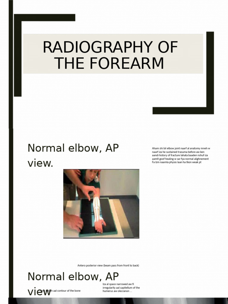 Radiography of Forearm Powerpoint | PDF | Elbow | Thumb