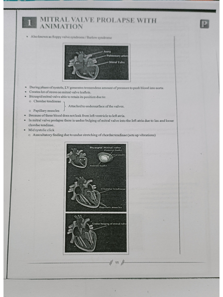 Mitral Valve Stenosis | PDF