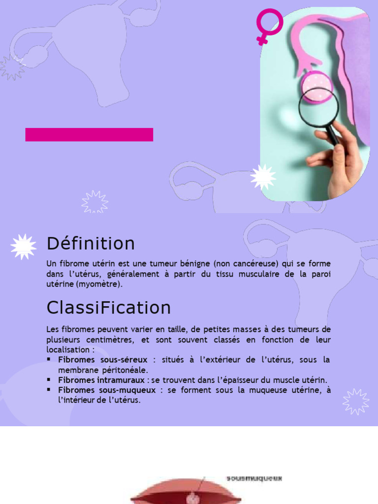 Fibromes utérins : définition et traitement | PDF | Utérus | Gynécologie