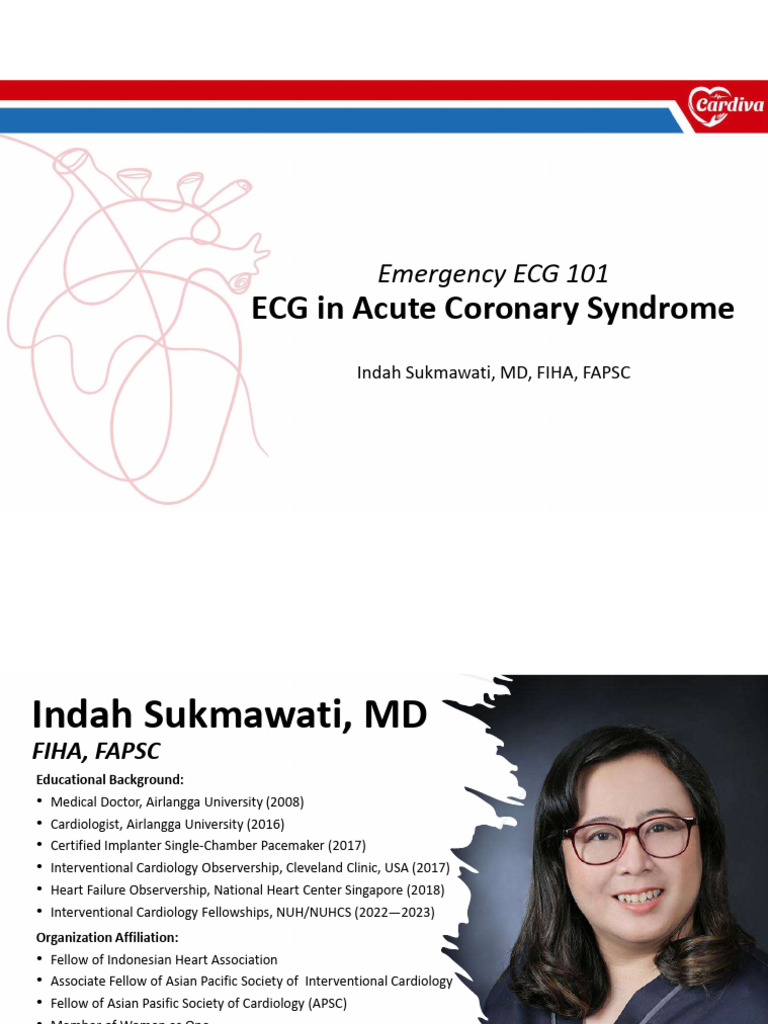 ECG Insights for Acute Coronary Syndrome | PDF | Myocardial Infarction ...