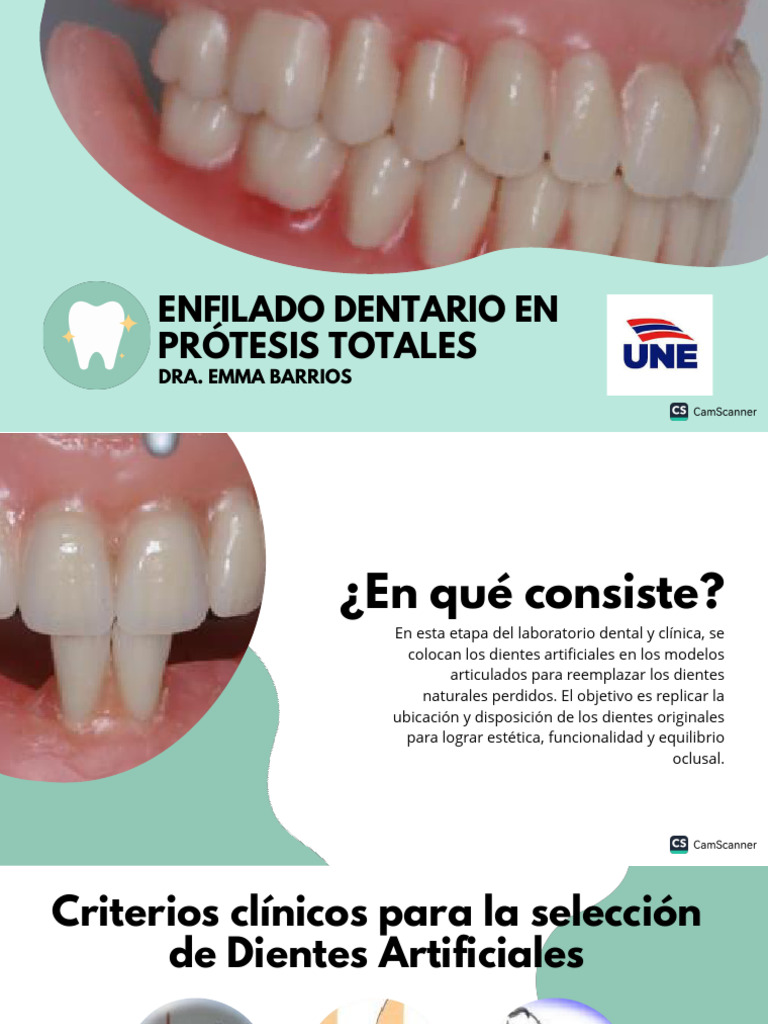 Enfilado Dentario en Prótesis Totales | PDF | Odontología | Ramas de ...